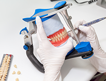 入れ歯専門の医師と技工士の連携